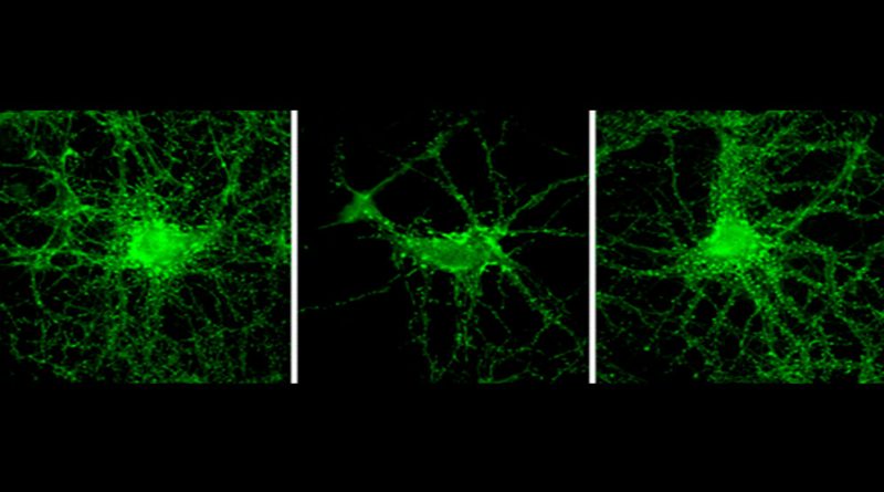 Logran revertir déficits de la memoria en un modelo experimental del Alzheimer
