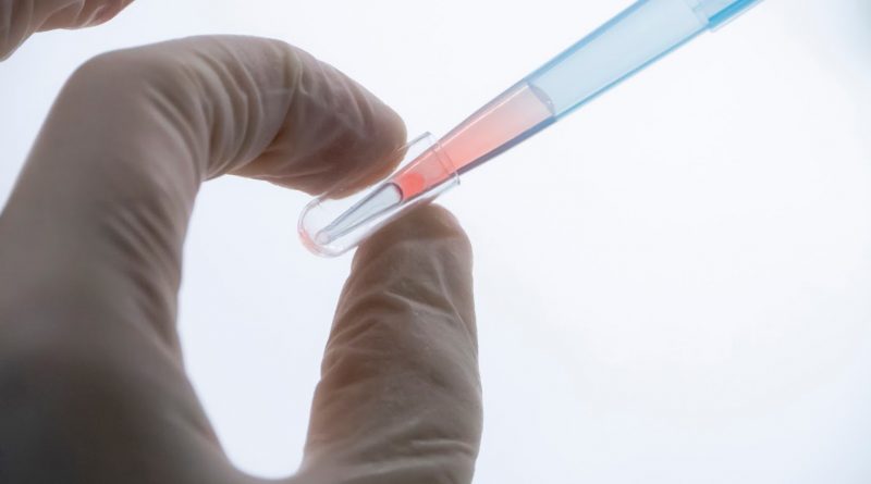 El Conicet desarrolla un test de detección precoz del cáncer de mama y de próstata